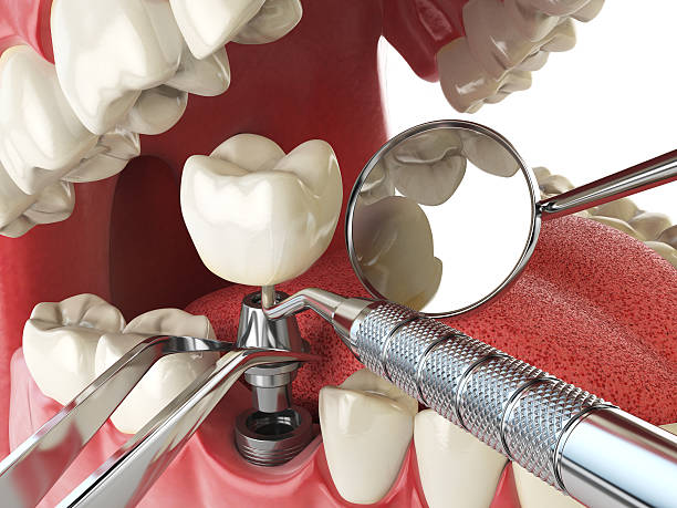 Best Emergency Cosmetic Dentistry in Venice, IL